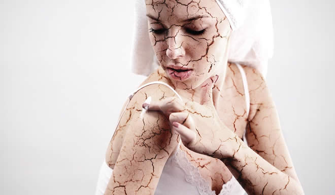Essential Common Facts to be Know About Dry Skin